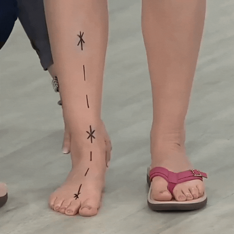 Pylera™ | Orthopedic Summer Sandals for Ultimate Comfort